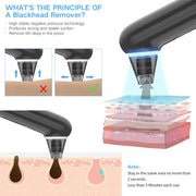 Electric Beauty Instrument Face Pore Remover Blackhead Acne Cleaner(Black)
