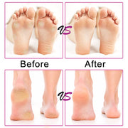 Electric Foot File Speed Adjustable Sandpaper Discs Callus Remover Pedicure Fast Remove Feet Hard Cracked Dry Dead Skin Tool, Plug Type:US plug(Black)