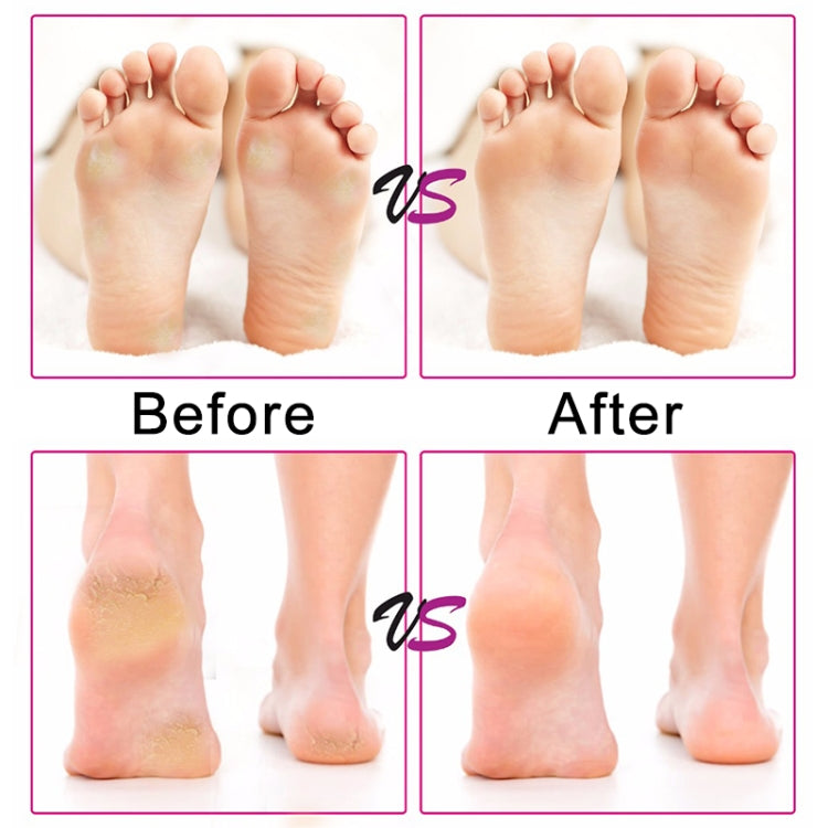 Electric Foot File Speed Adjustable Sandpaper Discs Callus Remover Pedicure Fast Remove Feet Hard Cracked Dry Dead Skin Tool, Plug Type:US plug(Black)