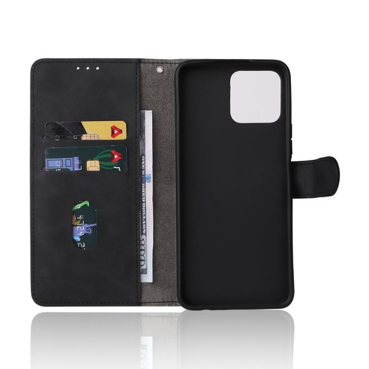 For Honor X8 Skin Feel Magnetic Buckle Calf Texture PU Phone Case(Black)