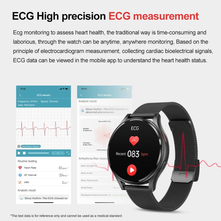 1.43 inch Silicone Strap Bluetooth Call Smart Watch Support ECG / Non-invasive Blood Sugar(Light Yellow)