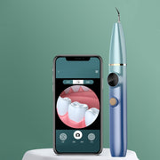 FY-B700 Visual Ultrasonic Scaler Tartar Calculus Tooth Stain Remover Dental Beauty Instrument(Blue Gradient)