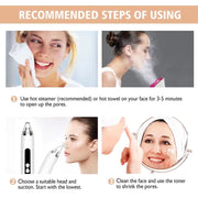 Blackhead Remover Vacuum Pore Cleaner Facial Deep Cleaning Beauty Tools(White)