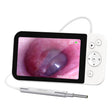 Teslong MS500 5 Inch HD Screen Illuminated Ear Pickers 3.9mm Diameter Visual Ear Care Tool - free shipping - PMC TechLife - Order now!
